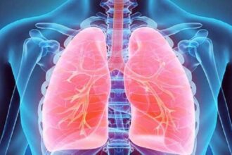 Juru Bicara Kementerian Kesehatan RI dr. Mohammad Syahril mengatakan pendeteksian tertinggi penyakit TBC berkat adanya komitmen dari pemerintah dan surveilans yang semakin gencar. Foto: healthvision.in